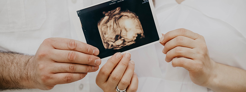 anuncia tu embarazo de manera creativa